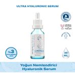 Acqua Perfection 30 ml Yoğun Nemlendirici Hyaluronik Serum