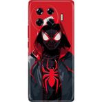 Adasena Tecno Spark 20 Pro Plus+ Kılıf Desenli Baskılı Tpu Rubber Kapak Retrospider - 001-Renkli