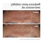 Aesco Niacinamide ve Çinko Içeren Serum, 30ML ile Cilt Bakımına Destek Sağlar