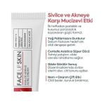 Alkar Ticaret Akne Kremi Yüz Için – Sivilce ve Akne Karşıtı Leke Kremi – Salisilik Asit & Niasinamid ile Leke Giderici – Genç ve Yetişkin Cilt Bakımı, 40 ml