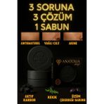Anatolia Soap Aktif Karbon Sabunu Arındırıcı Gözenek Arındırıcı Yağ Dengeleyici Saç Derisi Bakımı