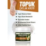 Ayak Tırnak Mantar Bakım - Topuk Çatlak Beyazlatıcı Etkili Krem 150 ml