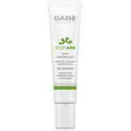 Babe Stop Akn Spot Control 8 ml Akne Kurutucu Stik