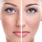 Beauty Face Antipigmentasyon Sabunu