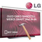Best Ekran Lg 75" Inç 189 Ekran Tv Ekran Koruyucu LED Nanocell OLED QLED Qned Smart Webos 4k-8k - 75 inç