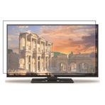 Bestoclass Vestel 40FA7100 Uyumlu Tv Ekran Koruyucu