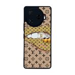 BG AKSESUAR Tecno Camon 30 Pro ile Uyumlu Kılıf, Yumuşak Silikon, Koruyucu, Şok Emici, Mat Siyah, LouisVuitton Desen