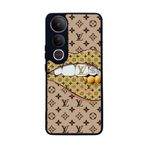 BG AKSESUAR Vivo V50 Lite Uyumlu Kılıf, Yumuşak Silikon, Koruyucu, Şok Emici, LouisVuitton Desen, Siyah