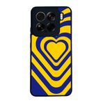 BG AKSESUAR Xiaomi Mi 15 ile Uyumlu Fenerbahçe Tasarımlı Silikon Kılıf, Sarı-Lacivert, Çiziklere ve Darbelere Karşı Koruma