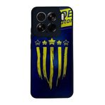 BG AKSESUAR Xiaomi Mi 15 ile Uyumlu Fenerbahçe Tasarımlı Siyah Silikon Kılıf, Çiziklere ve Darbelere Karşı Koruma