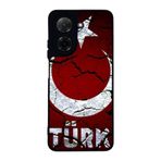 BG AKSESUAR Xiaomi Redmi A5 Uyumlu Göktürkçe Türk Yazılı Baskılı, Mat Siyah, Yumuşak Silikon, Şok Emici Koruyucu Kılıf
