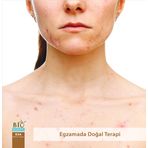 Biosoapy@ Doğal EXA Egzama Sabunu 100 gr x 2 adet (Egzamada Doğal Terapi)