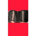 Borkaon Hairon Plus Mavi Serum ( 1 Adet )