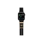 Casen Watch Akıllı Saat Uyumlu Kordon Takısı Şık Charm Seti Love Yazılı Gold Aksesuar Süsü