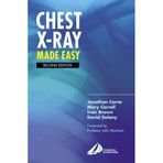 Chest X-Ray Made Easy by Corne MA PhD FRCP Dr., Jonathan, Carroll Dr., Mary, Delany (2002) Paperback