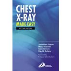 Chest X-Ray Made Easy by Jonathan Corne MA PhD FRCP Dr. (3-May-2002) Paperback