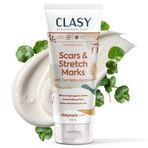 Clasy Care Scars & Stretch Marks Yara ve Çatlak İzleri Görünümünü Azaltıcı ve Önleyici Krem 100 ML