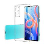 Coverzone Xiaomi Mi 12 İle Uyumlu Kılıf Süper Şeffaf Silikon Kapak