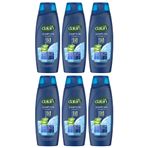 Dalan Şampuan Aloe Vera Özlü Kepeğe Karşıt Etkili 450 ml x 6 Adet