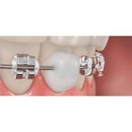 Dentalsepet Ortodontik Wax Diş Teli Mumu 5 Sıra Blok Mum ile Ağız Yaralarını Önler