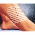 Dermateks 3m Steri-Strip Dikiş Bantı 12 mm x 100 mm 6 Şerit R-1547 5 Adet