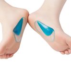 Düz Taban Rahatsızlığı(Pes Planus) Olanlar İçin, Kendinden Yapışkanlı, Ayakkabı İçi, Silikon, Ark Desteği Takviyesi (1 Çift) (Mavi)