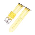 E2M Apple Watch 38-40mm KRD-23 Transparent Kordon -2 Sarı