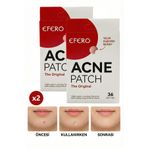efero Akne Ve Bandı Pimple Patch 72 Adet Patch