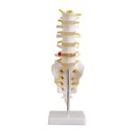 EgeAnatomi Maketleri Lumbar Vertebra (Sakrum Koksiks ve Fıtıklı) Modeli