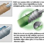 Elixir 15425 125 Tek Bas Gitar Teli
