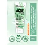 Elvons Sivilce Ve Akne Kremi- 50 Ml