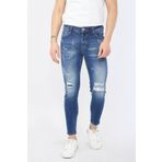 Erkek Skinny Fit Yırtık Detaylı Jean Koyu Mavi