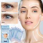 Fanxicm 60 Adet Protein Konu Hiçbir Iğne Altın Protein Hattı Emilebilir Kollajen Yüz Germe Anti Aging Hyaluronik Sıkma Cilt Araçları (Yurt Dışından) - Renkli