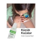 Fırsat Mağazam Vıtayes Sos Cilt Serumu - Akne ve Sivilce Önleyici, Siyah Nokta, Cilt Kızarıklığı, Kaşıntı, Sinek Böcek Isırması Karşıtı Onarıcı Çay Ağacı Yağı ve Provitamin B5 Serumu, Üçlü Ambalaj 30 ml - Option-1