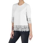 FSM1453 Kadın Pamuklu Modal Yetim Kol Comfort Fit Güpürlü T-shirt 2414