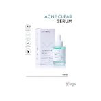 Gndz Store Anyong Sivilce Karşıtı, Yatıştırıcı Azelaik Asit%5 Serum 30 ml (Centella Özü & Prebiyotik)