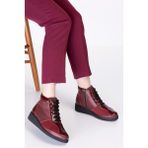 Gondol ERT.3870 Bordo Hakiki Deri Anatomik Taban Kemik Çıkıntısına Özel Kadın Bot