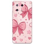 Gramaphone Xiaomi Mi 13 ile Uyumlu Kurdele Desenli Telefon Kılıfı + Ekran Koruyucu - 5803