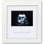 Green Pollywog | Sonogram Resim Çerçevesi | Beyaz Çerçeve | Ultrasonik Çerçeve | İlk Kez Anneler için Hamilelik Hediyeleri | Bebek Ultrasonik Resim Çerçevesi | Ebeveynler/Büyükanne ve Büyükbaba için Hediyeler | Çocuk Odası Dekoru
