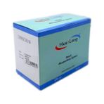 Hualong 0.30x60 200 Adet 1 Kutu Steril Akupunktur İğnesi