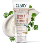Hype Store Yara Izi ve Çatlak Giderici Krem – Centella Asiatica, Vitamin E ile Cilt Yenileyici – Doğum Sonrası, - Standart