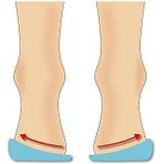 Icemen 505 Silikon Topukluk, İçe Dışa Basma Düzeltici, 4 Beden (Xs-L),%100 Silikon Yapı (S (34-37))