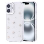 Kilifplus Apple iPhone 16 Pro ile Uyumlu Kılıf Şeffaf Simli Airbag Tasarımlı Kapak, Darbe Emici, Kamera Korumalı, [ Tam Uyumlu, Zarif, Kaliteli ], Yıldız