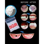 Kurbaa Pro Thermo Granül Geçici Diş, Eksik Diş Giderme, Kırık Diş Onarımı, Diş Dolgusu ve Diş Uzatma Için Diş Onarım Diş Tamir Granülleri - 5 GRAM