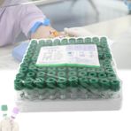 Lityum Heparin Kan Toplama Tüpü,Vacutainer Kan Toplama Tüpleri,0.5ml/1ml,Plastik Malzeme,Mikro Kan Örneklemesi,Kürek Ağız Tasarımı,100 Adet,Hayvanlar Ve Çocuklar İÇin,0.5ml