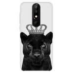 Lopard Casper Via P3 Uyumlu Leopar UV Kılıf