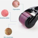 Macgon Dermaroller Titanyum Uçlu 540 Iğneli Derma Roller 0,75 mm Iğne Cilt Yüz Vücut Yenileme Masaj Aleti
