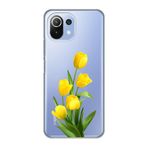 Manitoba Xiaomi Mi 11 Lite ile Uyumlu Baskılı Yumuşak Silikon Şeffaf Telefon Kılıfı, Sarı Lale Deseni