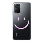 Manitoba Xiaomi Redmi Note 11 Pro/Note 12 Pro 4G ile Uyumlu Gülen Yüz Tasarımlı Baskılı Şeffaf Telefon Kılıfı