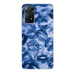 Manitoba Xiaomi Redmi Note 11 Pro/Note 12 Pro 4G ile Uyumlu Mavi Dudaklar Tasarımlı Baskılı Şeffaf Telefon Kılıfı